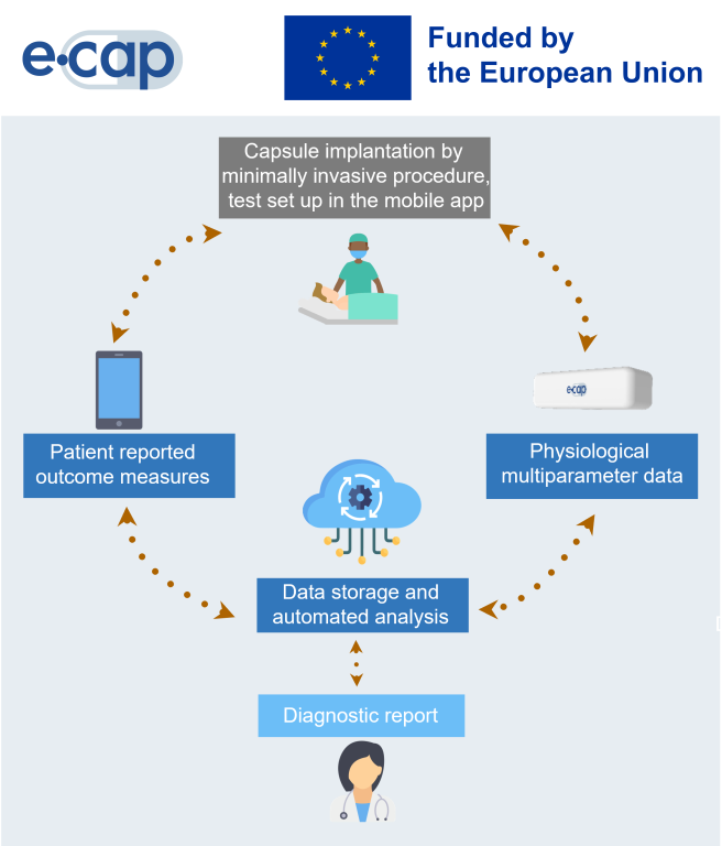 Graphic overview of eCAP technology